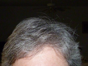 Photo of my forehead and hair